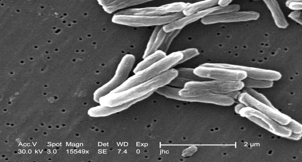 Bacteria Mutates in Space